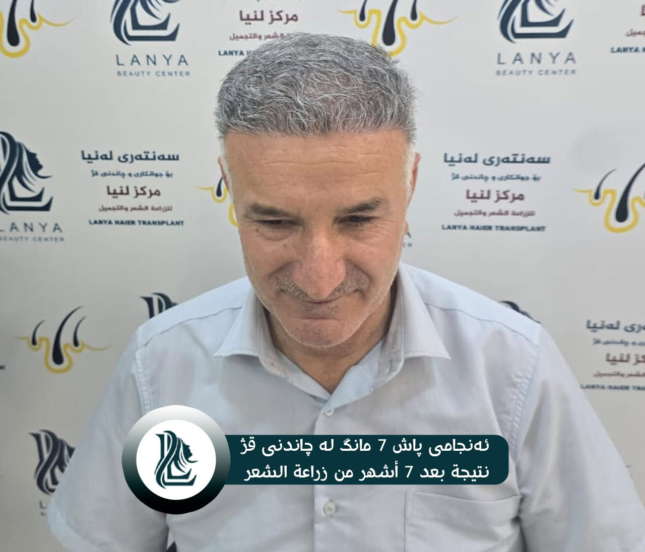 "لأن شعرك سر جاذبيتك، أعد له الحياة مع خبراء لـنـيـا."
🔹 نتائج زراعة الشعر ممیز والفريدة من نوعها تظهر دائمًا في مركز لەنیا .
♦  مع لەنیا حافظ على شبابك.
📍 العنوان:كلار - شارع ليوا - قرب جامع بخاري
📞 رقم التواصل:
***********
🔸🔸🔸🔸🔸🔸🔸🔸🔸🔸🔸🔸🔸🔸
🌿قژی چڕتر، ڕووخسارێکی جوانتر 🌿
چاندنی قژ لە لەنیا، هەنگاوێک بۆ دڵنیایی و جوانی زیاتر.
🔹 ئەنجامی چاندنەوەی قژی بێ وێنە و ناوازە هەموو کات لە سەنتەری لەنیا دەبینرێت 
♦ لەگەڵ لەنیا هەمیشە بەگەنجی دەمێنێتەوە 
📍  ناونیشان: کەلار- شەقامى لیواکە - نزیک مزگەوتی بوخاری
📞  ژمارەی پەیوەندی: ***********
