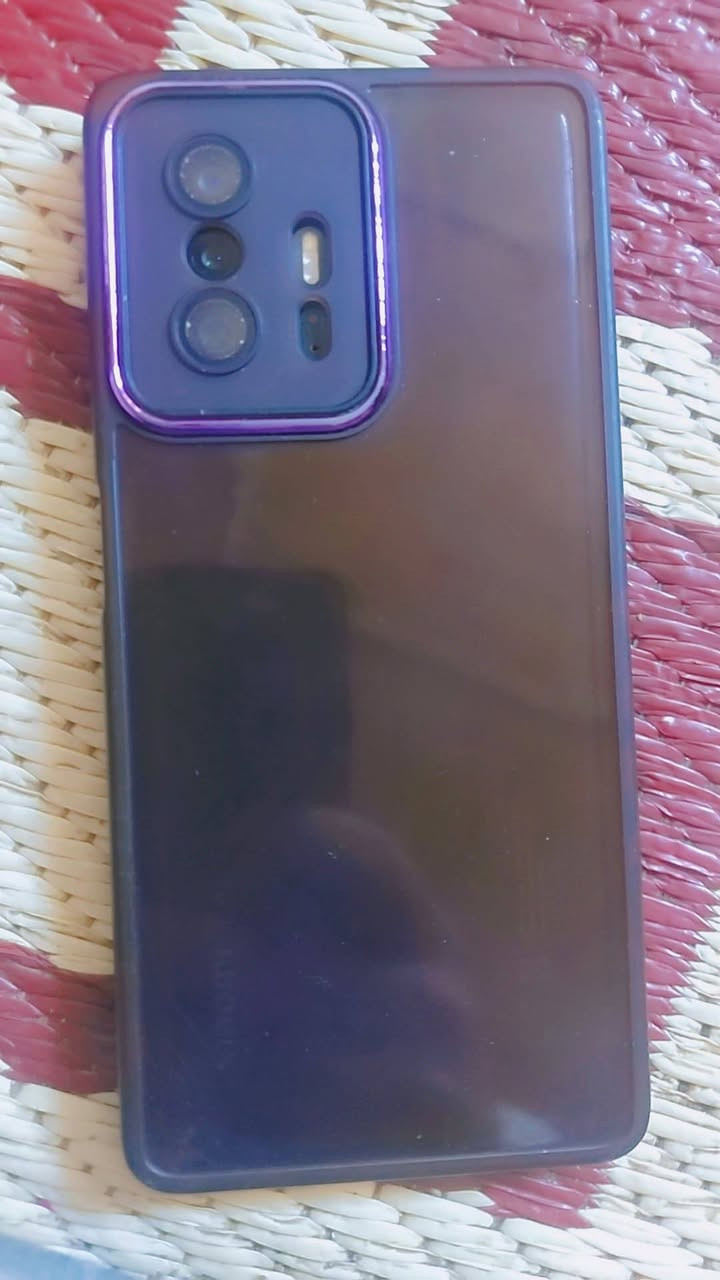 سلام عليكم مبايل ذاكرته 256 يدعم بوبجي 90 فريم مبايل مكفول من عده الضهر طاح من ايدي


**إذا كنت صاحب هذا الإعلان وتريد حذفه لأي سبب، رجاءا أرسل رسالة إلى الدعم الفني**