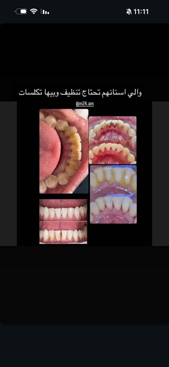 العلاج مجاني وتحت اشراف كادر طبي مختص
***********
