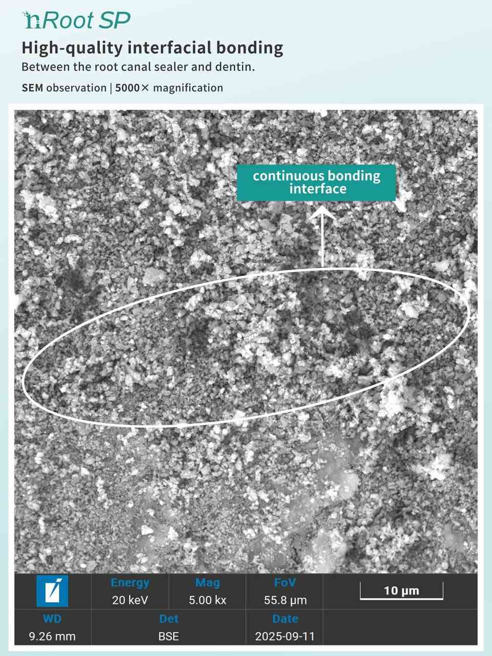 NRoot SP
Bioceramic Sealer 
من شركة ENP الرائدة عالمياً بمنتجاتها ودراساتها 
شنو يميّزه علميًا؟
‏🔹 Interfacial bonding قوي ويا العاج (Dentin)
حسب صور SEM:
 • يسوي bonding مستمر بين السيلر والعاج
 • يقلل الـ gaps والفراغات
 • يحسّن الإحكام (Seal) على المدى الطويل
‏🔹 Hydrophilic
يحب الرطوبة
يعني حتى لو القناة بيها رطوبة خفيفة، يشتغل بكفاءة عالية
(ميزة مهمة بحالات صعبة التجفيف)
‏🔹 Setting reaction حيوي
يتفاعل ويا الرطوبة ويسوي:
 • Calcium hydroxide
 • Calcium silicate hydrate
⬅️ هذا يساعد على:
‎ • التئام الأنسجة
‎ • تقليل الالتهاب
‎ • توافق حيوي عالي (Biocompatibility)
🔹 pH عالي بالبداية
 • تأثير مضاد للبكتيريا
 • مفيد بحالات الـ reinfection
🔹 انكماش شبه معدوم
على العكس من بعض السيلرات الراتنجية
⬅️ ثبات حجمي ممتاز
‏⬅️ Seal طويل الأمد

وين احنا؟📍📍‼️
دنتست ستور لمستلزمات طب الاسنان بغداد / باب المعظم / قرب فرع
مصرف الرافدين
للحجز والاستفسار:
0777 935 6962
0
