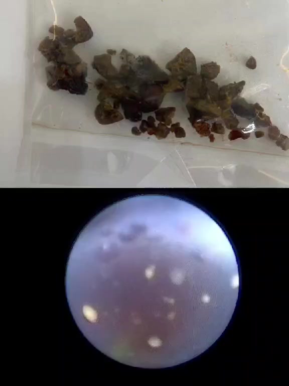 🔴سلام علیکم
🔴 غدا یوم الاحد دکتور سرکوت خورشید الداودی موجود بل عیادە 

🔴اتصاصی جراحە الکلی والمسالك البولیە و التناسلیە و البروستات و الضعف الجنسی و العقم

 🔴طوزخورماتو حی جمهوریە شارع حسن قوان مجمع سلام الطبي
🔴للحجز و الاستفسار  ***********
