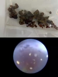 دكتور سرکوت • جراحة كلى ومسالك • طوزخورماتو