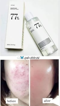 كوري • هارت ليف ٧٧٪ • مهدئ للبشرة الحساسة