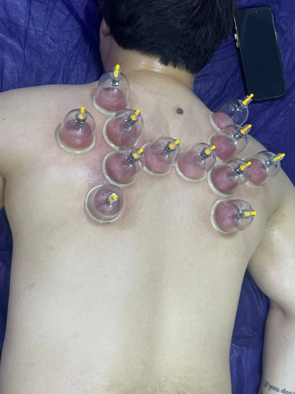 طوز خورماتو حي أمام احمد عيادة الوارث مقابل ماركت كرستال ابو مصطفى الليبي ***********5) #
