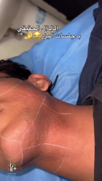 نتائج أسرع • جلسات أخف • المحمودية حي الربيعي