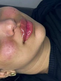 مدينة الصدر قطاع٦٧ • عيادة ايفا • تجميل وجه