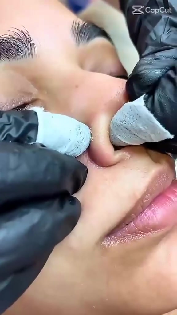 ✨ جزء من شغلنا في مجمع جيفارا الطبي ✨
أحدث الأجهزة وأفضل التقنيات للعناية والجمال بنتائج مميزة 💎

📍 مجمع جيفارا الطبي
جبلة / شارع الأطباء / مقابل عيادة الدكتور حميد الزيدي

📞 للحجز والاستفسار: ***********
