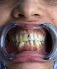 مو كل ابتسامة تنولد صح… بس الصح نعرف شلون نصلّحها 😌🦷  مراجعتنا جانت تع...