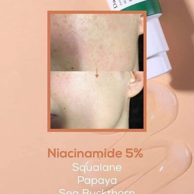 🌟 السيروم الكوري المُعجزة لتصفية البشرة! 🌟
AXIS-Y Dark Spot Correcting Glow Serum – 50ml
🇰🇷 أصلي 100% – ترند حالياً في العراق والوطن العربي ♨️

✨ يحتوي على 5% نياسيناميد + سكوالين
🍃 غني بـ 6 مستخلصات نباتية (الآذريون، البابايا، نبق البحر، نخالة الأرز...)

فوائده الساحرة:
✅ يعالج التصبغات ويوحّد لون البشرة
✅ يقلل آثار الحبوب ويخفف الالتهابات
✅ يرطب ويحمي بفضل السكوالين
✅ يقلل من دهنية البشرة
✅ يفتح البشرة ويعالج الهالات والبقع

🌿 طريقة الاستخدام:
ضعي كمية صغيرة على الوجه أو الأماكن المتأثرة، صباحاً ومساءً.
يُمتص بسرعة ونتائجه تبهرك من أول أسبوع!

🚗 توصيل لكل محافظات العراق 

📦 الكمية محدودة – احجزي الآن قبل النفاد!


**إذا كنت صاحب هذا الإعلان وتريد حذفه لأي سبب، رجاءا أرسل رسالة إلى الدعم الفني**