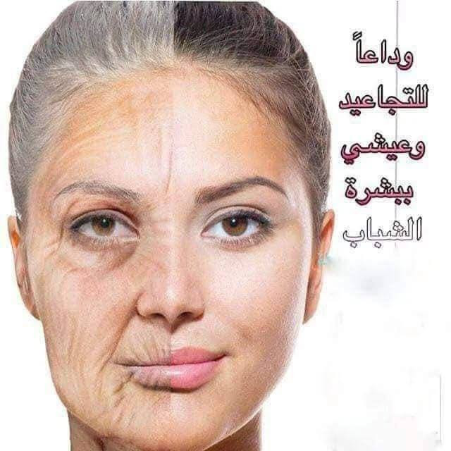 كريم وصابونة بوتوكس من ماجستي ♥️ 
‏ MAJESTY BOTOX CREAM
التايلندي 🇹🇭 الاصلي 💯 

كريم بوتوكس لتسمين وتبييض وازالة الخطوط والتجاعيد وحمايه البشرة من الشمس ويعتبر كريم ماجستي بوتوكس من افضل المنتجات التايلندية لانه يعمل على نفخ الخدود كما يعالج البشرة من التجاعيد والترهلات بعد الضعف والحمل ✔️

ويقوم ايضا بشد البشرة ويعطيها بياضا ناصعا ويعيد الشباب للبشره ويقضي ع التصبغات

لانه يقوم باعادة البشرة الى شكلها الطبيعي ويعيد توازنها ويجعلها اكثر شبابا  لاحتوائه كمية كبيرة من المياه النقية وفيتامين C 
واحتوائه ايضا على مادة الكولاجين collagen 
القضاء علامات التقدم بلسن والشيخوخة المبكرة
ويمنع حدوث الخطوط والسواد والانتفاخ حول العينين . ويعالج تجاعيد وسواد الرقبة . 
كما يحتوي على واقي من اشعة الشمس SPF30 *
المنشأ تايلندي اصلي 🇹🇭🇹🇭

سعر البكج 20الف


**إذا كنت صاحب هذا الإعلان وتريد حذفه لأي سبب، رجاءا أرسل رسالة إلى الدعم الفني**