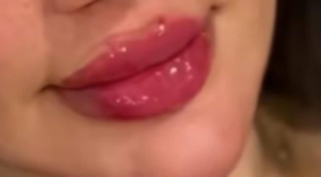 عروض الفلر نوعيته كلو بلاص الفرنسي ،والايطالي السيسي 50البلازمه المفعله بي اربي 30الجلسه والبوتوكس الكندي 40 وتغير وجه كامل  بلفلر  250 والغمازه 25 والبرنسك 25باختصاص دكتورة بنات هاي عروض بصالون الانيقه ***********
