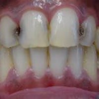 نستلم الحالات الي بالصورة العلاج مجاناً  07716913889