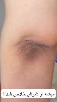 جل مقشر كوري • حجم كبير • توصيل متوفر