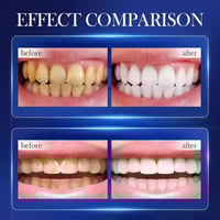 معجون أسنان • ROREC SADOER • ٣٠٠غ