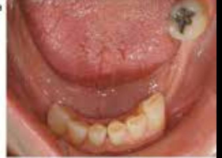 السلام عليكم
الي فاقد اسنان تشبه الحالات البصور يراسلني واتساب
***********
العنوان الكرادة شارع ٥٢ جامعه اوروك
