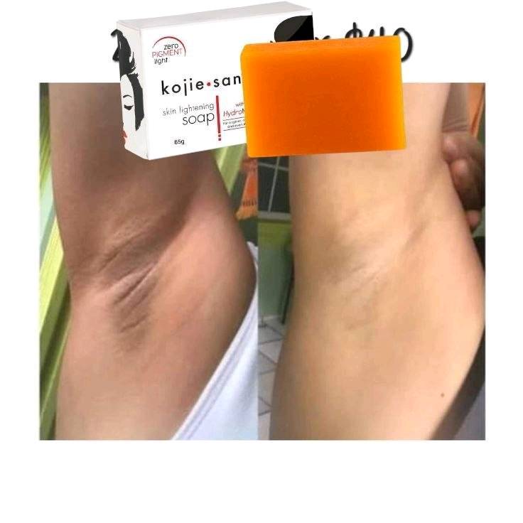 🧼✨ صابونة كوجي سان الأصلية – الغنية عن التعريف 💯
#الأصلية #الفلبينية 🇵🇭

صابونة Kojie San الشهيرة اللي توصّي بيها أغلب أطباء الجلدية 👩‍⚕️👨‍⚕️
تحتوي على حمض الكوجيك الفعال لتفتيح البشرة وتوحيد اللون 🌟
تنظّف، تفتح، وتخلي بشرتچ ناعمة ومتوهجة 😍

🧴 طريقة الاستخدام:
استعمليها يومياً للوجه والجسم مثل الصابون العادي ✔️

💸 السعر: 5آلاف دينار فقط 🇮🇶
متوفرة الآن .. لا تفوتين الفرصة! 😉