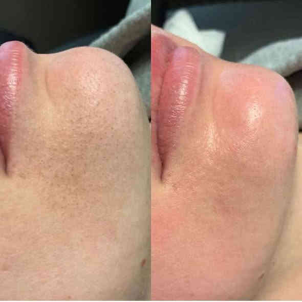 اهلا وسهلا زبوناتنا الجميلات رضائكم هو غايتنا ولتكوني مميزه 🎀
اسعارناً مناسباً 📍✨
تنظيف البشرة هايدرو ب15
تنظيف البشرة ملكي ب25
حفافة 5
شمع للوجه  8
بديكير 10 مع املاح طبيعية 
الماكير 20
سحب لون شعر قصير 20 واسط 25 فما فوق حسب طول الشعر
صبغ شعر قصير جدا 15 المتن 25 الوسط 35 الطويل حسب طول الشعر 
ميش كثيف قصير 25 فما فوق حسب طول الشعر
تسريح الشعر يخلي شعرج سرح حسب طول الشعر 
قص 5 اي قصه 
معالج لترميم وتغذية الشعر القصير 30 فما فوق حسب طول الشعر
اهلا وسهلا بلجميع 
مركز ألين للتجميل
العنوان//كربلاء حي الرباب قرب سيد سماعيل 
الحجز //***********
***********
