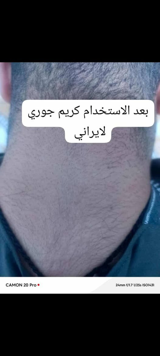 📣 عاجل  "جوري سكين الايراني"! بـ 18 ألف وبس والتوصيل بلاش!!! 📣 توفر توصيل داخل العراق الأول مره. 
بنات، أستغلو ا العرض@ شفتوا هاي الصور اللي بالمنشور؟ ، هاي حقيقة واقعية! نتائج تجنن وصدمة حقيقية لزبوناتنا اللي قرروا ينهون معاناتهم مع مشاكل البشرة! 💯💥
تعبتي من حب الشباب وآثاره اللي مخربة وجهج؟
سوّيتي تقشير وندمتي لان سوالج تصبغات؟ 
المناطق الحساسة والركب والأكواع مسببت لج إحراج؟ (شوفي الصورة 
تردين بشرة زجاجية ونعومة خيالية مثل "الكيمر"؟ 
الحل السحري لكل مشاكلج صار بين ايدج! 😉
مقشر جوري سكين مو بس مقشر، هو الحل النهائي والجذري! بتركيبة فريدة تشتغل على عمق البشرة، تجددها، تفتّحها، وتخفي كل التصبغات والآثار. ✅✨
عرض "جوري سكين" الذهبي (اللي ما يتكرر):
بمناسبة العطلة، ولأننا نحب نفرحكم، سوينا الكم أقوى عرض بالعراق:
🎁 مقشر جوري سكين بـ 18 ألف دينار بس!!!
🎁 والتوصيل مجاني لكل مناطق العراق!!!
أي نعم، التوصيل بلاش عليكِ! يعني بس تدفعين 18 ألف والمقشر يوصلج لبيتج! 🚗💨
لحكي، لا تضيعين الفرصة! الكمية محدودة جداً والطلب هواي، والكل يريد يجرب النتائج الحقيقية! 🏃‍♀️🏃‍♀️🏃‍♀️
احجزي مقشرج الآن ببلاش التوصيل! راسلينا على الخاص
#جوري_سكين #بشرة_زجاجية #نتائج_حقيقية #قبل_وبعد #تفتيح_المناطق_الحساسة #عناية_بالبشرة #حب_الشباب #آثار_حب_الشباب #تصبغات #عرض_العطلة #توصيل_مجاني #العراق #ميسان #بغداد #البصرة #اربيل #اكسبلور #تريند #جمال #نعومة #كيمر


**إذا كنت صاحب هذا الإعلان وتريد حذفه لأي سبب، رجاءا أرسل رسالة إلى الدعم الفني**