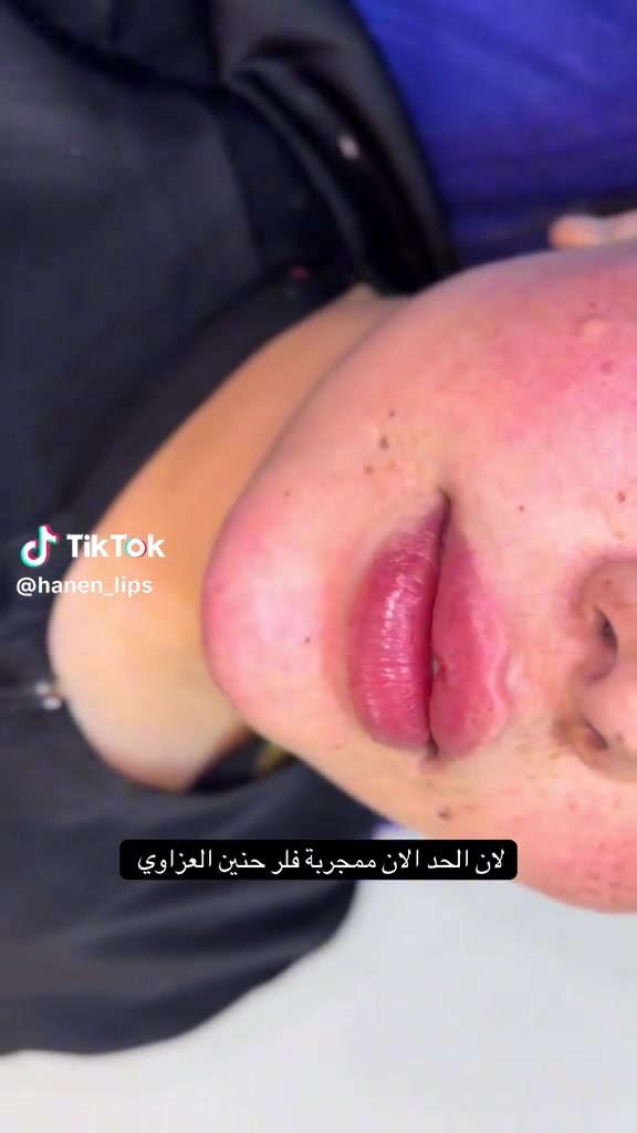 Haneen Alazzawy  عيادات خبراء الطب التخصصي د.كتورة حنين العزاوي شوفلي الجمال 😍😍


**إذا كنت صاحب هذا الإعلان وتريد حذفه لأي سبب، رجاءا أرسل رسالة إلى الدعم الفني**