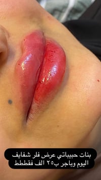 استغلي العرض الثلاثاء والاربعاء ❤️ مع اسعار رمزية للخدمات الي مو من ضم...