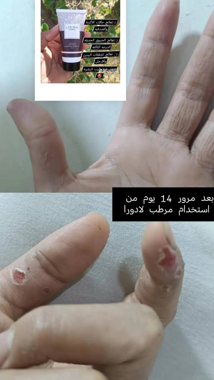 نتيجه من احسن منتجات اليرانيه احسن تجارب المنتجات كريم اليكس وصابونه الصنوبر @أبرز المعجبين


**إذا كنت صاحب هذا الإعلان وتريد حذفه لأي سبب، رجاءا أرسل رسالة إلى الدعم الفني**