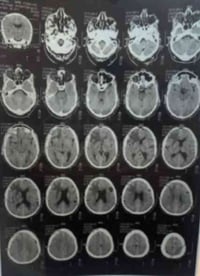اي استفسار عن الحالة تقارير صور تحاليل هذا الواتساب راسلوني وبخدمتكم  ...