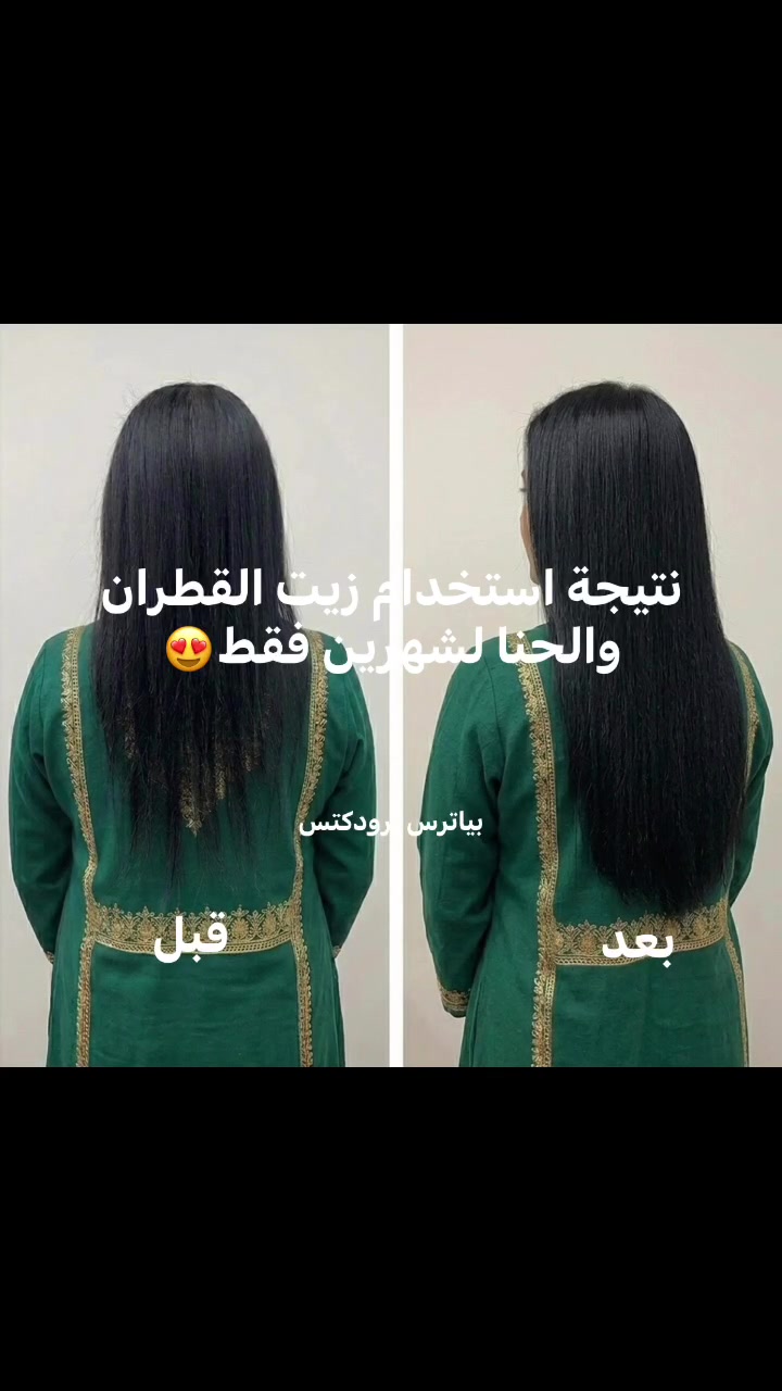 زيت تطويل وتكثيف الشعر ب اسرع مده


**إذا كنت صاحب هذا الإعلان وتريد حذفه لأي سبب، رجاءا أرسل رسالة إلى الدعم الفني**