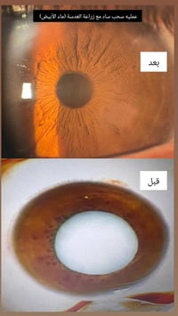 دكتور قاسم • الحصوه • طب وجراحة العيون