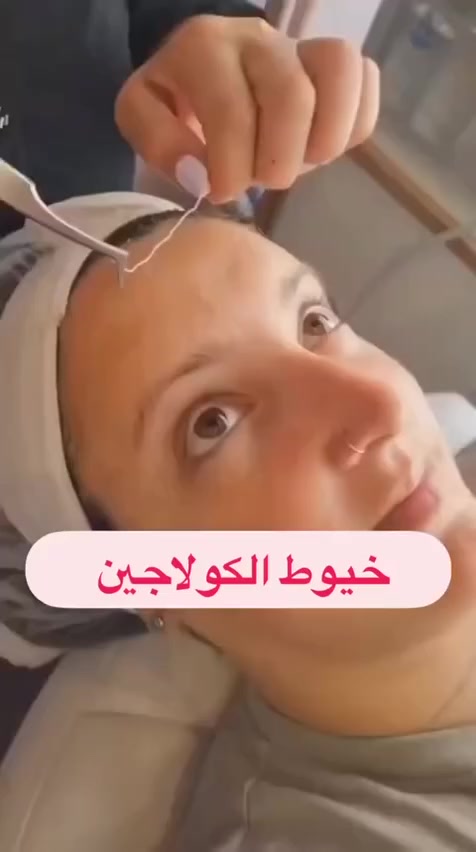 خيوط الكولاجين لاخفاء التجاعيد لمدة تفوق 3 شهور وبطريقة سهلة من غير جراحة تجميلية . سيروم كولاجين  مع خيوط الكولاجين #الاصلي حصرررررى وعندنا بسسسسس فى مارتينا  سنتر
🌟 يتم تركيبها في المنزل بكل سهولة
يعني باي باي للتجاعيد بدون تدخل جراحي😍❤

أحدث تقنيه تجميل بدون ألم او حقن او جراحه او تورم واحمرار 🔥🔥،،،،،،،،
خيوط البروتين تخترق سطح البشره وتعوض مكان الكولاجين والالستين المفقود في الجلد فتقوم بشد الجلد وتنعيم التجاعيد والبشره ،،،،،،،

خيوط الكولاجين لعلاج التجاعيد وجعل البشره اكثر شبابا وحيويه 💃💃💃💃💃💃

تستخدم 🔺🔺🔺

للتجاعيد حول العين 🔺🔺
تجاعيد منطقه الجبهه 🔺🔺
تجاعيد حول الفم والخطوط التعبيريه 🔺🔺

تعطي توهج الشباب مدهش لبشرتك😍
لها تأثير قوي على شد ورفع الجلد😎

السعر :
قطعة / 18
قطعتين / 27
توصيل  بغداد 4المحافظات 6


**إذا كنت صاحب هذا الإعلان وتريد حذفه لأي سبب، رجاءا أرسل رسالة إلى الدعم الفني**