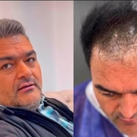 نتيجه ٧ اشهر بعد الزراعه 🌹   ✨✨مع الوطني الاماراتي  احجز الان دون تردد...