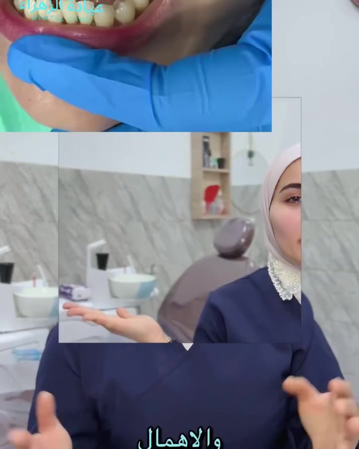 تخيل تصحى بيوم وتلقى أسنانك "تتحرك"؟ 🦷⚠️ الموضوع مو كابوس، هذا واقع إهمال التهاب اللثة!
لهم نزيف اللثة وقت الفرشاة شي طبيعي وعادي، أو يلاحظون اللثة صايرة حمراء ومتورمة ويأجلون مراجعة الطبيب.
الحقيقة المرّة؟ التهاب اللثة إذا ما اتعالج بالوقت المناسب، يبدأ يأكل بالعظم الساند للسن. والنتيجة؟ الأسنان تبدأ تتحرك من مكانها، وممكن تنفقد تماماً حتى لو كانت سليمة وما بيها أي تسوس! 💔
الخبر السار والمطمئن: اللثة نسيج ذكي جداً، وإذا لحقنا على الالتهاب بمراحله الأولى بجلسة تنظيف وإزالة التكلسات العمومية، ترجع تبني نفسها وتتمسك بأسنانك وتثبتها من جديد. ✨
لا تنتظر السن يتحرك علمود تتحرك! احجز موعدك هسة بـ "عيادة الزهراء" وخلينا نطمن على صحة لثتك. 📥📞*********** #صحةوجمال #صحةوجمال_
