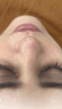 جلسه تنضيف بشره هيدروفيشيال 🤍🔥
فوائد تنضيف البشره :

✅-إعادة النضارة للبشرة الباهتة وتحسين ملمس البشرة.
✅-تقليل إفراز الزيوت في البشرة الدهنية 
✅-تخليص البشرة من الرؤوس السوداء والبيضاء.
✅-تحفيز الكولاجين الذي يعطي نتائج فورية.

العنوان الخاجيه شارع 40 داخل السوق لعصري 🌲 حبايبي اسم مالتنه نونه اكرلك ماعدنه غير فرع
***********
