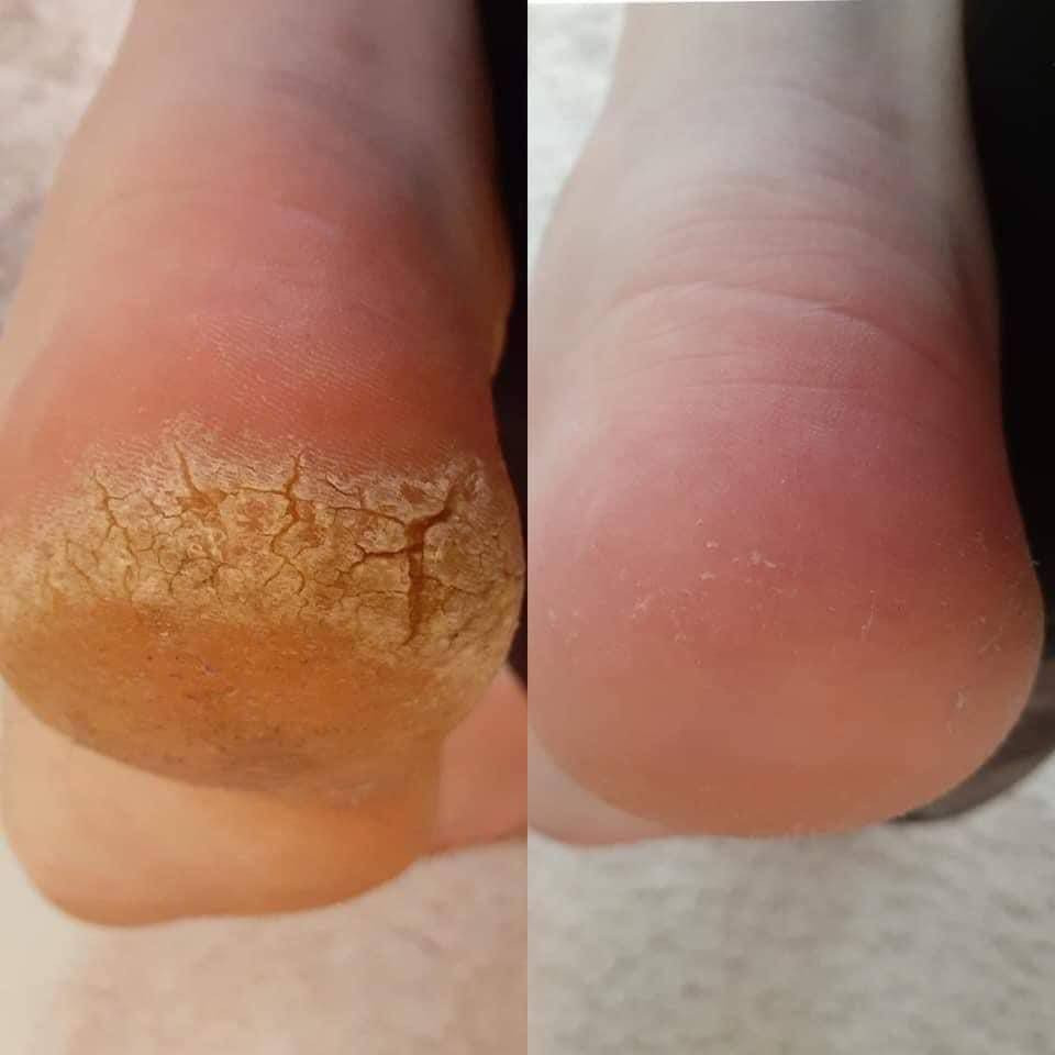 سنتر رواسي للتجميل 💈
صالون نسائي✂️
بغداد-الاعظمية📍
واتساب للحجز-***********
متواجدين من 10ص الى11 م🕦
