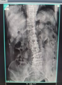 اعلان اعلان اعلان اخر يوم من العرض الرمضاني غدا الخميس  اجور اي فحص ب١...