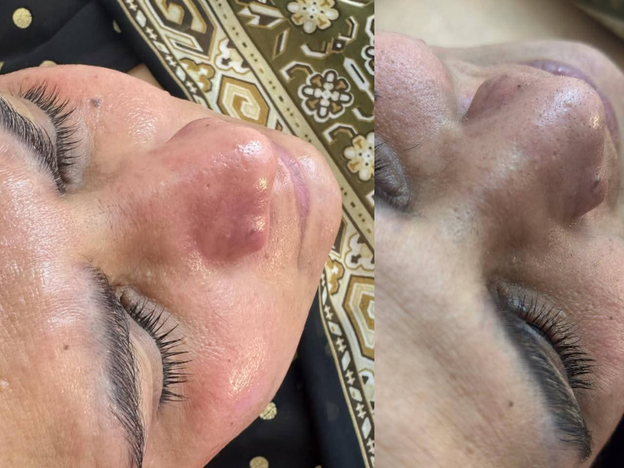 جلسة تنظيف البشرة مو بس عناية… هي تجديد كامل لبشرتك 🤍

فوائد جلسة تنظيف البشرة:
• إزالة الرؤوس السوداء والبيضاء
• تنظيف المسام بعمق
• التخلص من الدهون والأوساخ المتراكمة
• إعطاء نضارة ولمعان طبيعي للبشرة
• تساعد البشرة تمتص الكريمات والعلاجات بشكل أفضل


**إذا كنت صاحب هذا الإعلان وتريد حذفه لأي سبب، رجاءا أرسل رسالة إلى الدعم الفني**