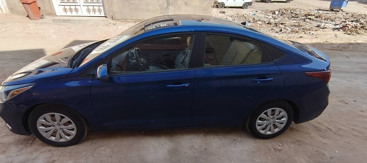 سلام عليكم سياره اكسنت للبيع سياره نضيفه
الاستفسار
***********
