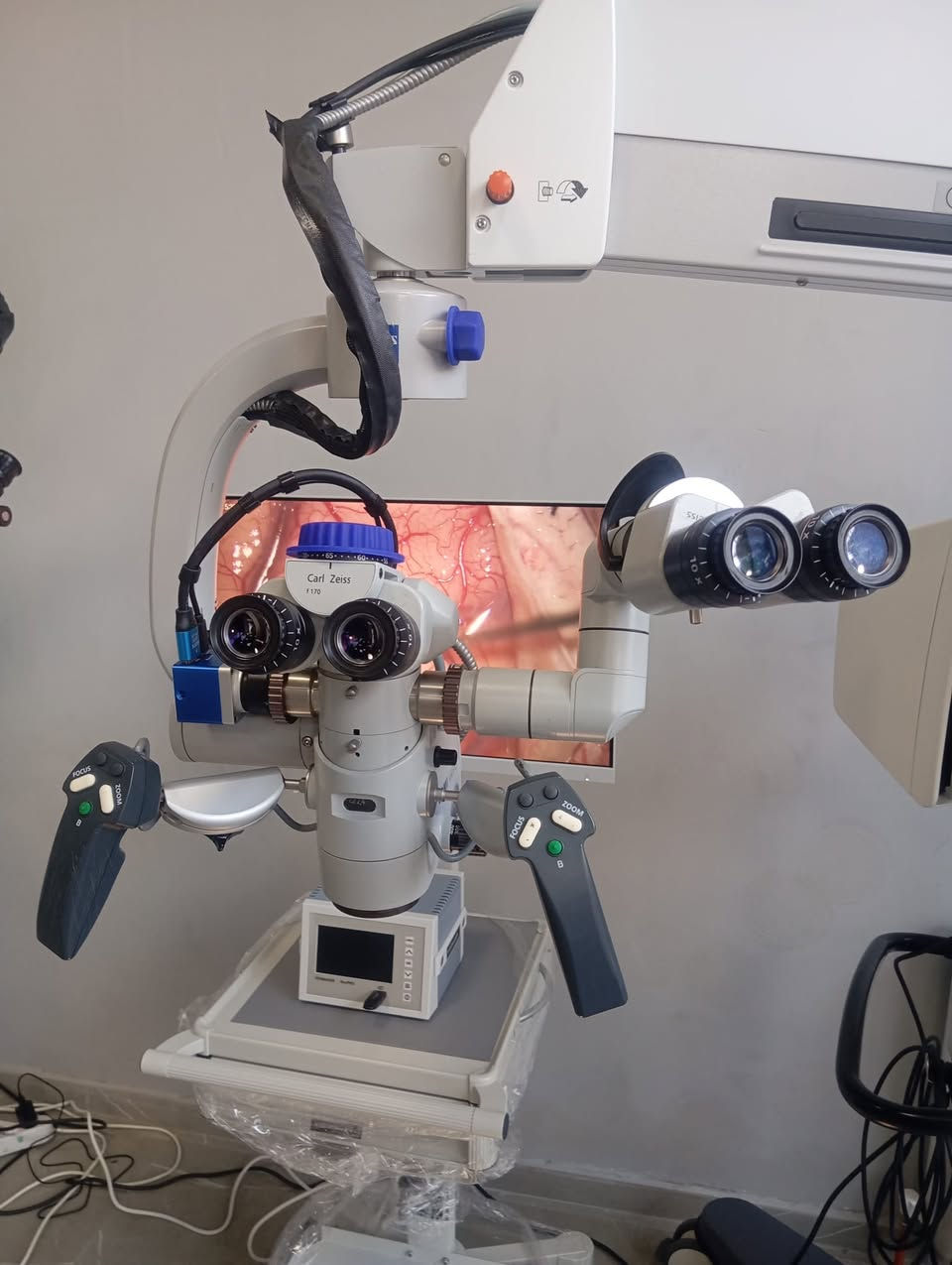 🔬 ZEISS OPMI Vario S88 | 2019 — Available Now

One scope. Every specialty.

Built for neurosurgery, spine, ENT & plastic surgery — the ZEISS OPMI Vario S88 delivers unmatched optical precision backed by the legendary ZEISS engineering.

⚙️ What makes it exceptional:

✔️ Apochromatic optics — stunning clarity & true color

✔️ 1:6 motorized zoom — instant, hands-free control

✔️ Varioscope internal focus — no lens swaps needed

✔️ 180W Xenon illumination — deep, shadow-free light

✔️ Electromagnetic braking — effortless yet rock-steady

✔️ S88 stand — magnetic locking joints, wide range of motion

✔️ HD video compatible — teach, record, document

📐 Working Distance: 200–415 mm

🔭 Zoom: 1:6 | Eyepieces: 10x / 12.5x

📹 Full documentation & co-observation ready

📩 DM us for price & availability.

We ship regionally. Fast response guaranteed.


**إذا كنت صاحب هذا الإعلان وتريد حذفه لأي سبب، رجاءا أرسل رسالة إلى الدعم الفني**