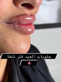 فلر شفة بدأ تغيييرات العيد حبايب   احسن شي ممكن تسوونه هسة طبعا الطراو...