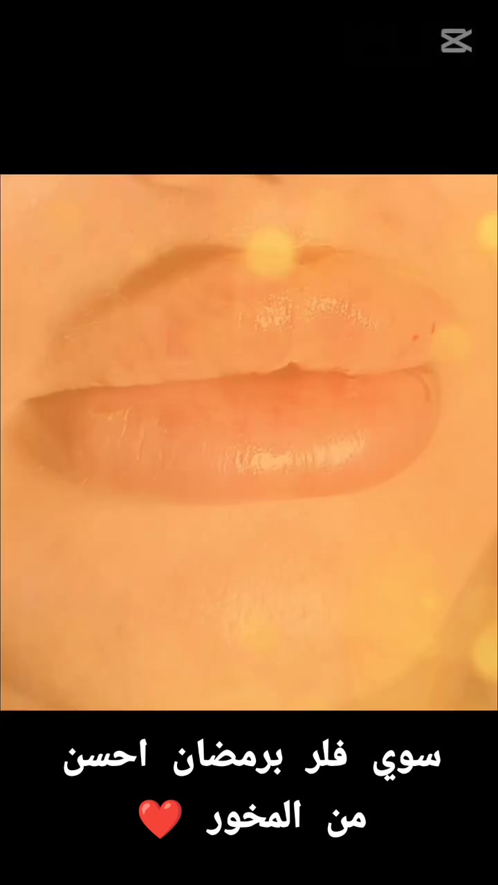 بغداد / الدورة/ شرطة ابو طيارة 
مقابل مكتب صلاح الدين  للعقارات 
***********
حور clinc - للتجميل والليزر
