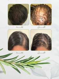 قطرات اكليل الجبل • تقوية الشعر • تقوية الحواجب