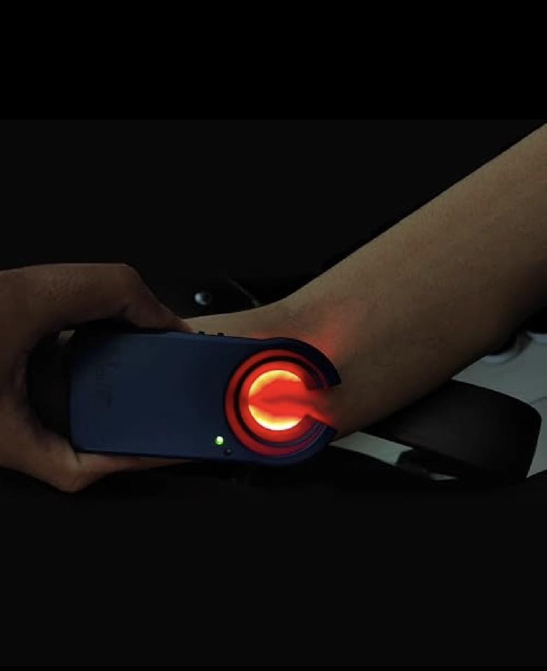 جهاز كشف الأوردة-Vein Finder
يساعد جهاز كشف الأوردة هذا المستخدم على تحديد الأوردة بوضوح.

بطارية قابلة للشحن تدوم طويلاً: يتميز جهاز كشف الأوردة VeinHunter ببطارية مدمجة قابلة للشحن تدوم حتى 3 ساعات من التشغيل المتواصل، وحوالي أسبوع عند الاستخدام المتقطع.

9 مستويات سطوع قابلة للتعديل: يوفر جهاز كشف الأوردة 9 مستويات سطوع قابلة للتخصيص، مما يسمح للمستخدم بضبط شدة الإضاءة حسب نوع البشرة، وظروف الإضاءة، وعمق الأوردة.

سهل الحمل والاستخدام: يتميز الجهاز بتصميم خفيف الوزن وسهل الحمل، مما يجعله مناسبًا للاستخدام في أماكن مختلفة. كما أنه سهل الاستخدام، مع أدوات تحكم بديهية تُمكّن من تحديد الأوردة وعرضها بكفاءة.

مناسب لجميع الأعمار والاستخدامات: يُنصح بتخفيف إضاءة الغرفة للحصول على رؤية أفضل.


**إذا كنت صاحب هذا الإعلان وتريد حذفه لأي سبب، رجاءا أرسل رسالة إلى الدعم الفني**