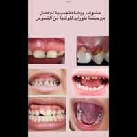 مرحبا موجوده عياده أطفال لعلاج أسنان الأطفال حشوات مجانا للتواصل خاص ا...