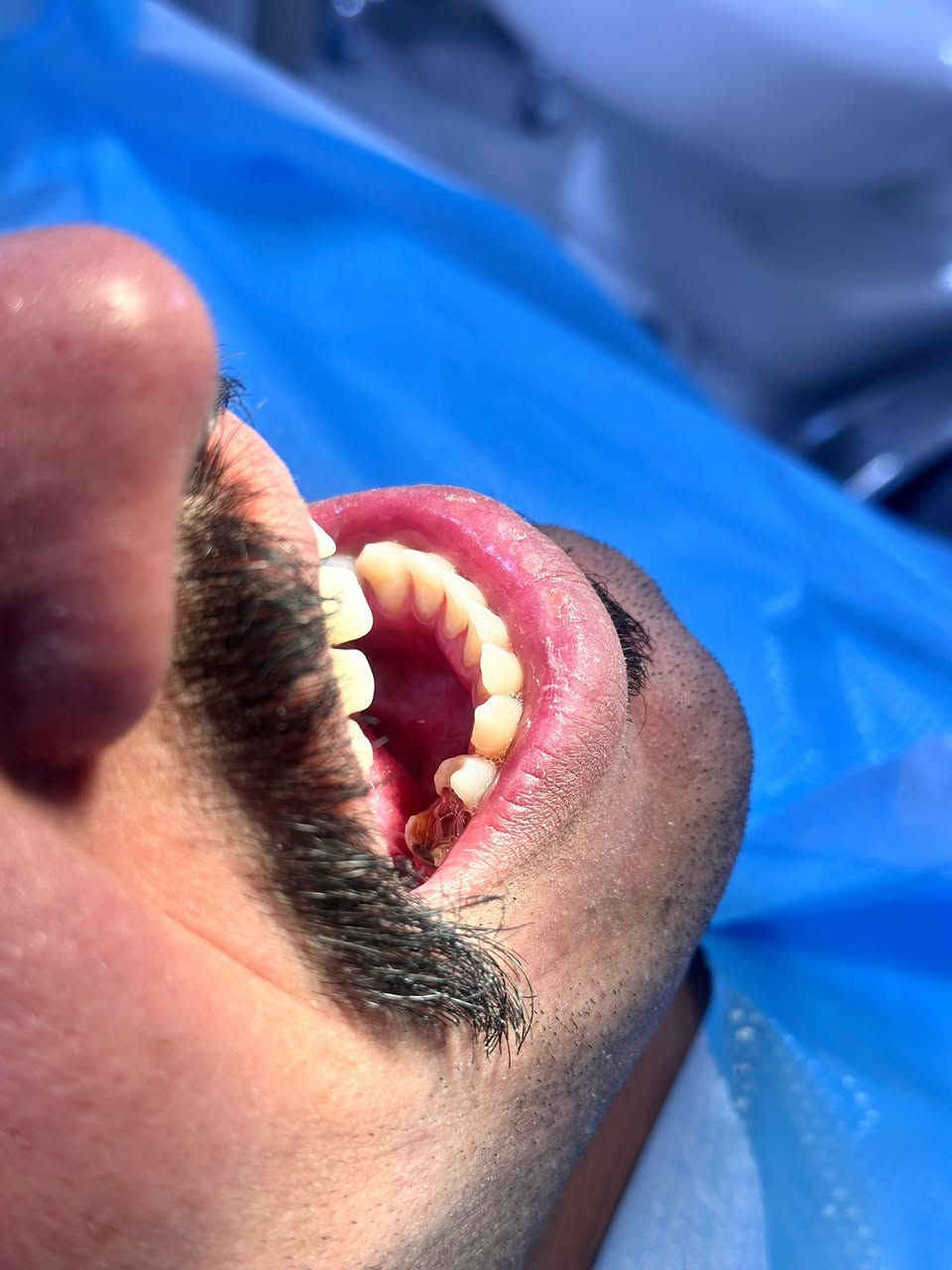 تنظيف وتلميع الاسنان ازاله التكلسات والتصبغات
قلع الجذور التالفه التسبب رائحه كريهه و التهابات في الفم  
قلع المتحركه اللبنية والدائمية
حشو الاسنان بالحشوات الضوئيه والتجميليه
المراسله خاص او على الرقم ***********
الكراده شارع ٥٢
