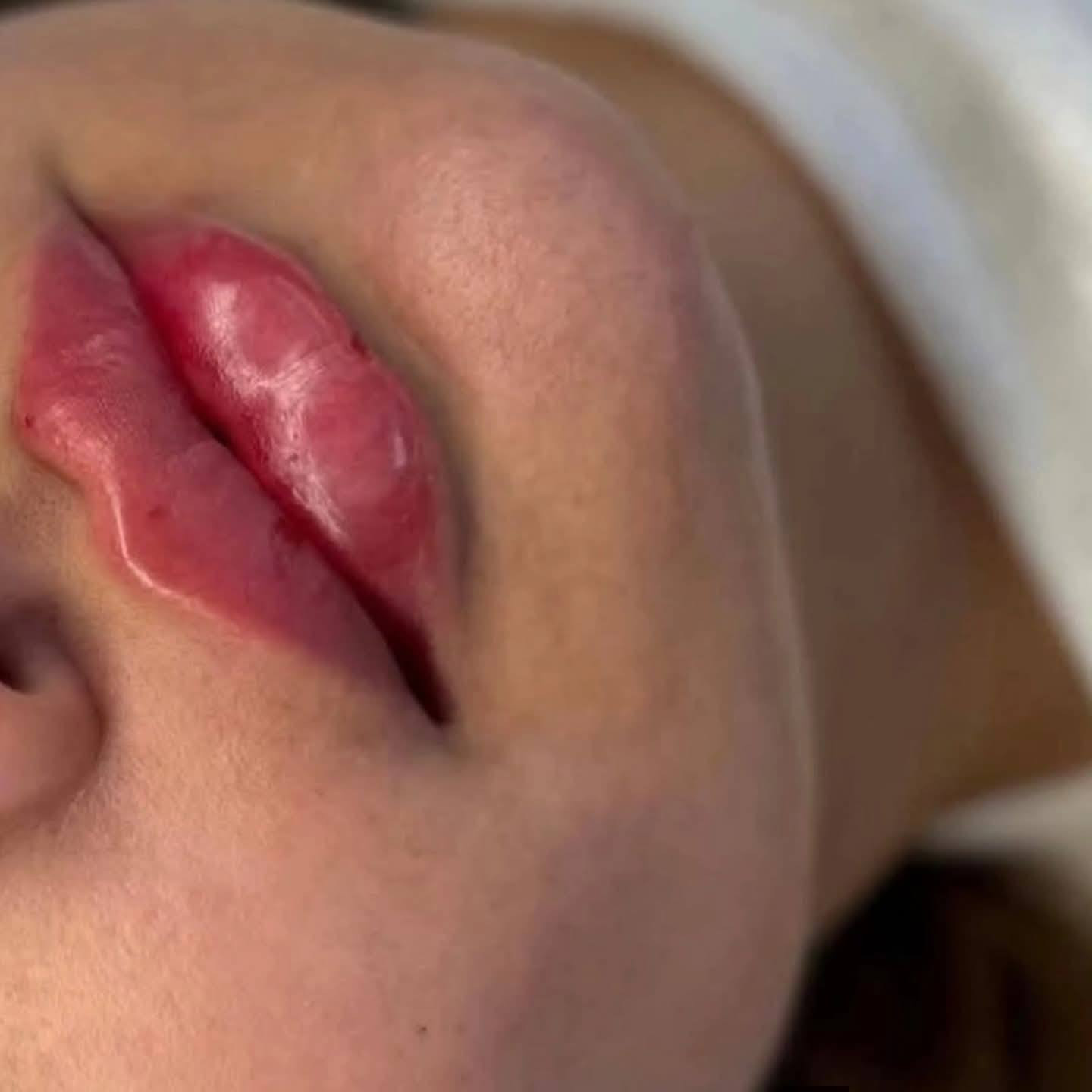 عروض العيد يم صالون الروان
فلر شفه بيد دكتوره صابرين مبدعه
خطم 80%عرض العيد على فلر الشفة مختلفه يمنه😍🔥🔥💋❤️⚘️✅️
احجزي الآن قبل انتهاء العرض 
للحجز والأستفسار 💋***********
