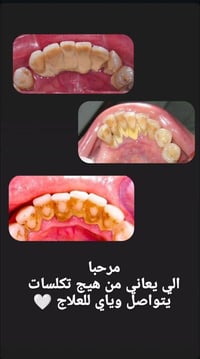 خدمة مجانية • تكلسات • العميد السعدية