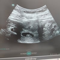 (يؤخر ...ليدبر)💐💐💐💐💐 حالة حمل جديدة تسجل للعيادة 🥰.... مريضة وزوجها بت...