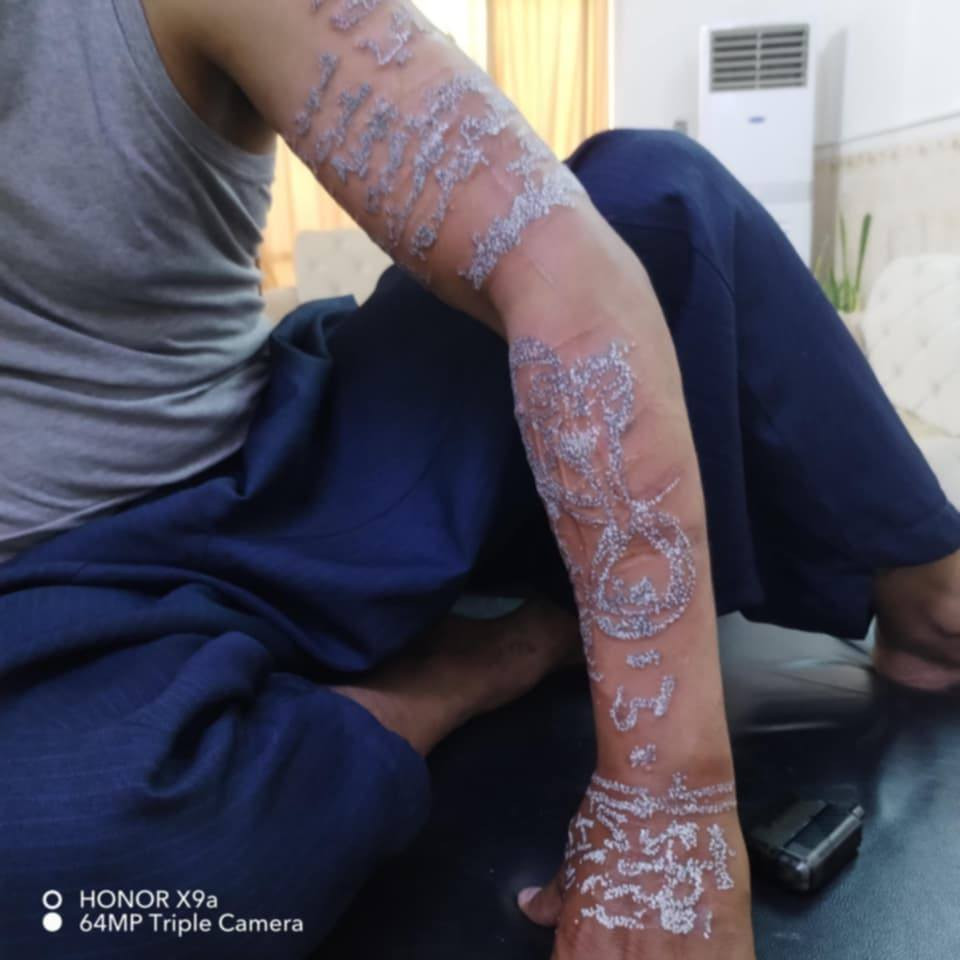 السلام عليكم اي مسح تاتو وشم دك ابر اني امسح وسعر مناسب مكان سايدين عروبه قرب جامع أمام علي فوق صيدلية عروبه ***********
