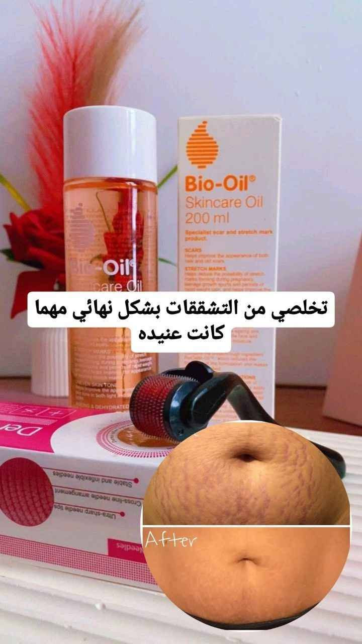 #عررررررض #خاااااااااااص
عرض زيت بايو اويل + درمارول 
افضل علاج لتشققات الجسم الحمر و البيض 🌺

البايو اوبل//يعالج علامات التمدد في الجلد، كما أنه يقوم بإخفاء الندبات 

ديرما رولر//𑸧بر الدقيقه جدا تعمل على تجديد خلايا الجلدد وتقليص المسام تخفي الندبات واثار حب الشباب وتحفزة انتاج الكولاجين للبشره
#تشققات_حمل_خطوط_بيضاء
#بنات_العراق #بنات_بغداد #هاشتاقات_تيك_توك_العرب #بنات_تيك_توك آفاق, القادسية


**إذا كنت صاحب هذا الإعلان وتريد حذفه لأي سبب، رجاءا أرسل رسالة إلى الدعم الفني**