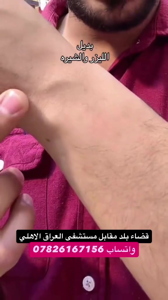 بودره مزيل للشعر 
للمناطق الحساسه وكافة لجسم
نسائيه ورجاليه
امنه وطبيه ع جسم
قضاء بلد مقابل مستشفى العراق الاهلي 
واتساب ***********
