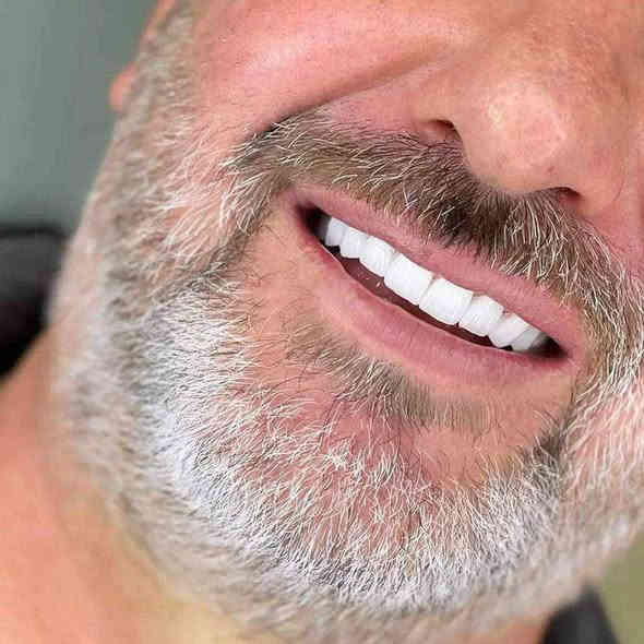 المختبر الفني السوري  لصناعة الاسنان
و التعويضات السنية وتركيب الأسنان
وبأنسب الاسعار بجميع المحافظات
العراقية 
ملاحظة لدينا كادر يزور المريض للبيت ويتم العمل في المنزل 
 للتواصل. ***********
